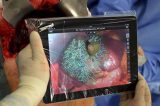 Hospital da Alemanha usa tablet para ajudar em cirurgia de fígado