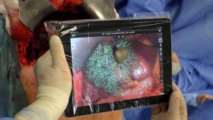 tablet-cirurgia