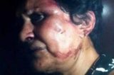 Atriz cubana ligada à dissidência é espancada por vizinhos em Havana
