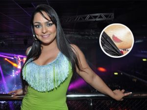 tatuagem-melancia-depilacao