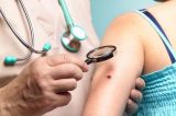 Exame de sangue pode detectar metástase em pacientes com câncer de pele