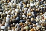 Por que a pedra no rim se chama cálculo?
