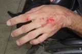 Deficiente físico é espancado com golpes de facão em Teixeira de Freitas