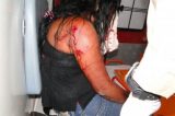 Mulher é esfaqueada pelo ex-marido dentro de carro ao sair do trabalho