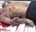Paciente reage a assalto e mata ladrão em clínica na Bahia