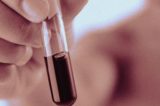 Biópsia líquida identifica câncer no sangue