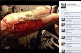 Mulher arranca pele com tatuagem após traição do namorado