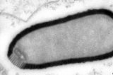 Vírus gigante de 30 mil anos ‘volta à vida’