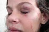 Jovem de 15 anos é agredida em escola por ser bonita, afirma pai