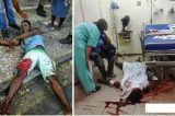 Homens invadem hospital na Bahia e executam paciente