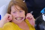 Mulher cola dente com super bonder com medo de dentista