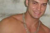 Modelo tem o rosto queimado com ácido quando saia de academia
