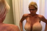 Mulher é operada após silicone estourar