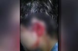 Homem corta orelhas e cabelos da esposa após descobrir suposta traição