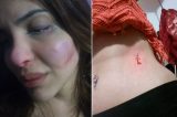 Transexual é esfaqueada: “Disse que não sou de Deus” Transexual é esfaqueada: “Disse que não sou de Deus”