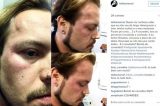 Marido de jornalista da Globo é espancado por taxistas ao tentar usar Uber Marido de jornalista da Globo é espancado por taxistas ao tentar usar Uber