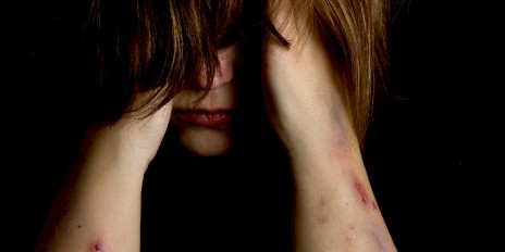 Violence victim