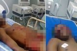 Foto de cadáveres em suposta página de batalhão da PM causa polêmica