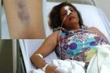 Sobrinha diz que tia foi torturada por médico enquanto estava internada em UPA