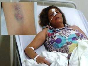 mulher upa