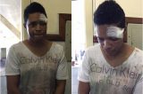 Homem é preso após se masturbar em ônibus e ser espancado por passageiros