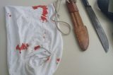 Homem é golpeado de faca por duas pessoas