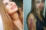 Jornalista é estuprada e torturada por sogra dos filhos e namorado