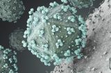 Pesquisadores japoneses descobrem proteína inibidora do HIV em seres humanos