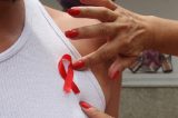 Remédio contra alcoolismo pode eliminar vírus da aids