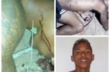 Jequié: ‘Pingo’ é morto por disparos de arma de fogo