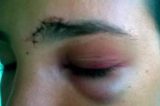 Polícia fará retrato falado para encontrar agressores