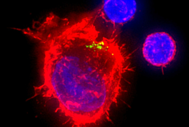 virus hiv