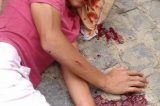 Acidente grave entre motoqueiros e animal em Juazeiro