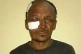 Lagoa Grande: Homem é preso por agredir mulher