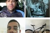 Ciclista é atacado por ladrão na Bahia e tem ossos da face quebrados