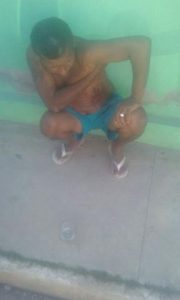 facada no homem1