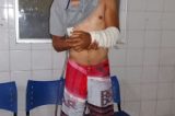 Envolvido no homicídio da Maniçoba teve alta