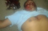 Acidente com vítima fatal em Sobradinho