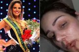 Ex-Miss grava vídeo e denuncia agressão de ex-marido na Bahia