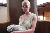 ‘Tenho medo de dormir’: a cruel caçada por ossos de albinos