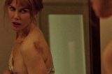 Nicole Kidman diz que marido ficou ‘devastado’ ao vê-la ferida após gravar cenas de agressão