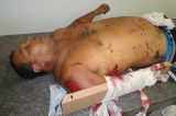 Pacientes em corredores e promessas vazias
