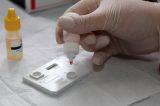 Novo remédio para paciente com HIV será testado