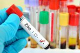 Vírus Zika pode ser usado no tratamento de tumor cerebral, afirmam pesquisadores