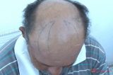 Mulher tatua chifre na cabeça do marido com ajuda do amante