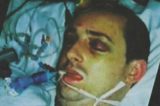 ‘Lesão cerebral provocada por espancamento brutal me deixou com risada patológica’