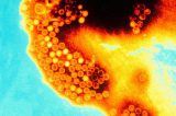 Hepatite A: como se proteger da doença que cresceu quase 11 vezes em São Paulo neste ano Hepatite A: como se proteger da doença que cresceu quase 11 vezes em São Paulo neste ano
