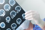 Conselho Federal de Medicina estabelece novas regras para determinar morte cerebral Conselho Federal de Medicina estabelece novas regras para determinar morte cerebral