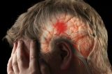 Como identificar os primeiros sintomas de derrame cerebral