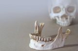 ‘Espetáculo e violência’: 11 fatos curiosos sobre o passado da Odontologia
